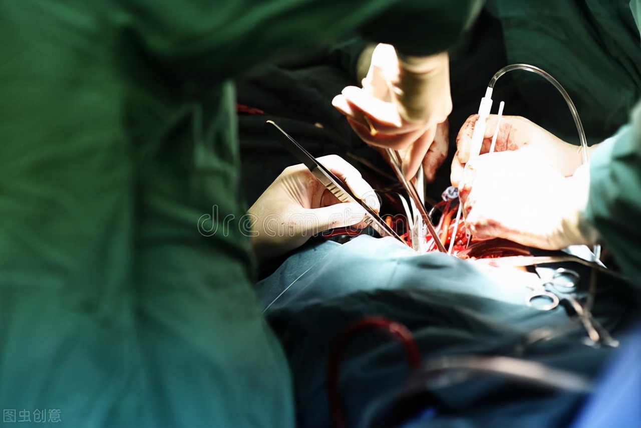 “腹”水难收？肝硬化腹水治疗宝典