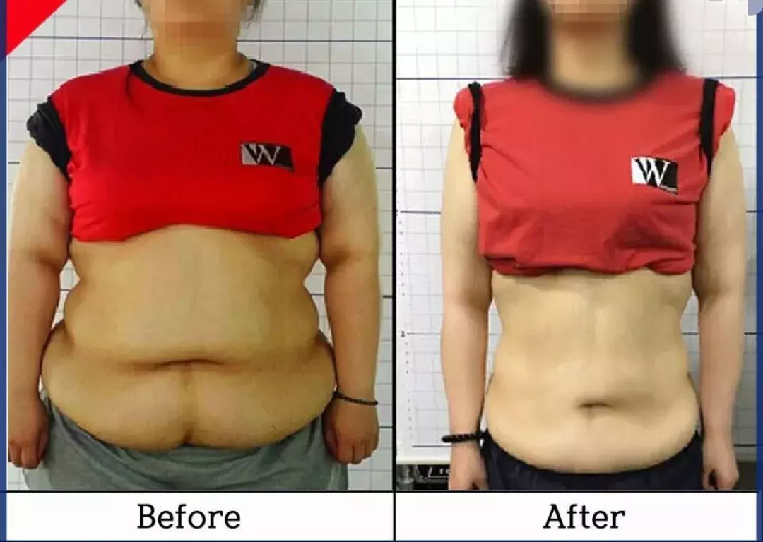 网友13天爆瘦食谱，“自残减肥法”自己买单！