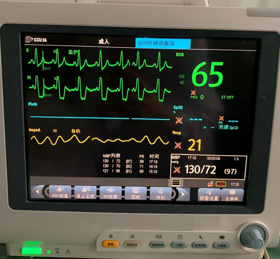 心电监护仪的应用，从四个特点详细剖析，有没有收藏价值看完便知