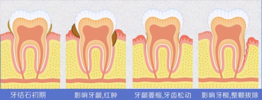 看个牙疼价格几十到几千，收费多少到底谁来决定？