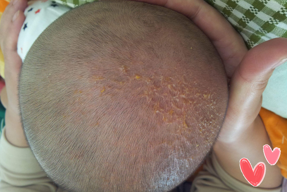 生了个毛娃娃",新生宝宝胎脂胎毛该咋处理?父母须看