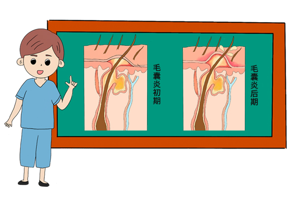 头皮疼痛并频繁长小疙瘩是怎么回事？