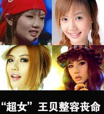 2010年,超女王贝携母整容命丧手术台,母亲私下和解的一幕耐人寻味