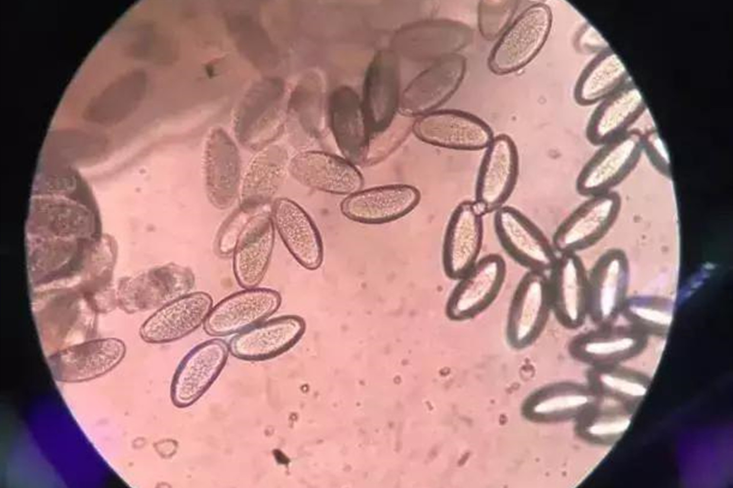 绕虫卵图片(宝宝边哭边抓) - 赤虎壹号