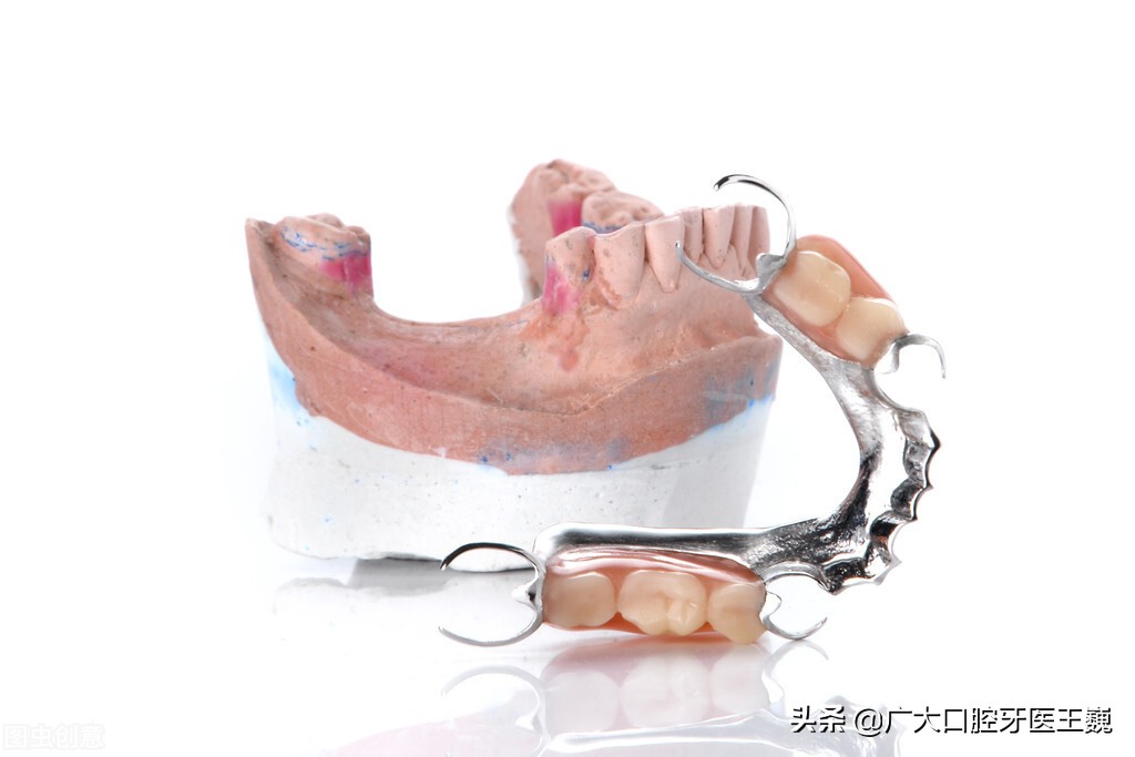 牙槽骨萎缩严重，可以试试这个办法，能够有效恢复一口好牙