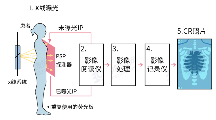 做一次X光和CT，对人体的伤害到底有多大？医生实话告诉你