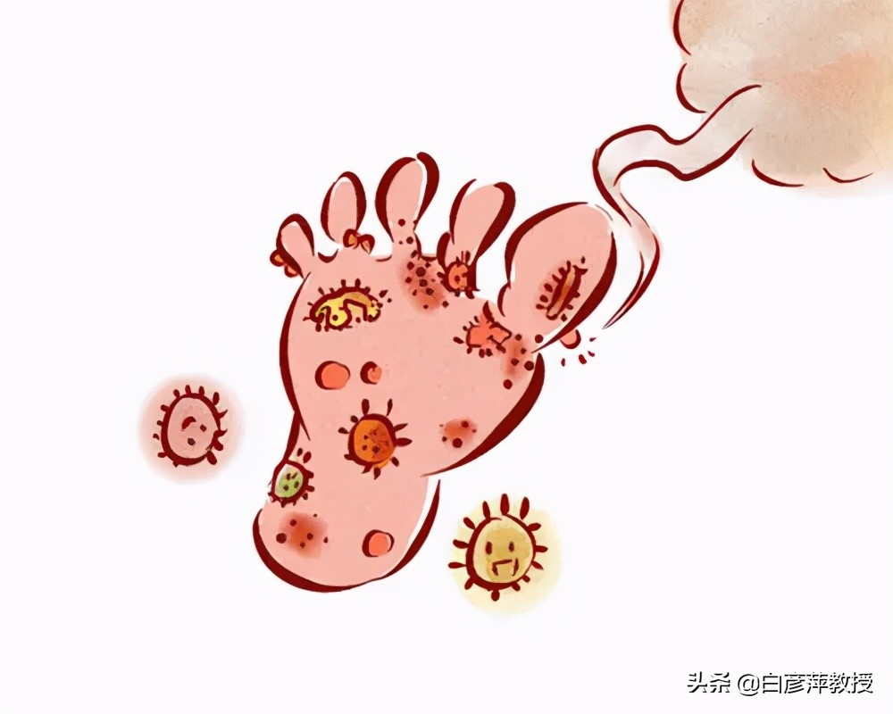 轻轻一划，皮肤上就凸起一道红痕？要警惕皮肤划痕症“作怪”