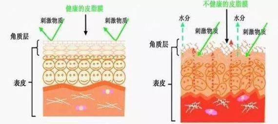 眼角干纹细纹怎么消除（正确护肤让你事半功倍）