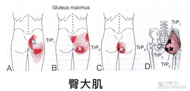 五,臀部肌肉及臀上皮神經