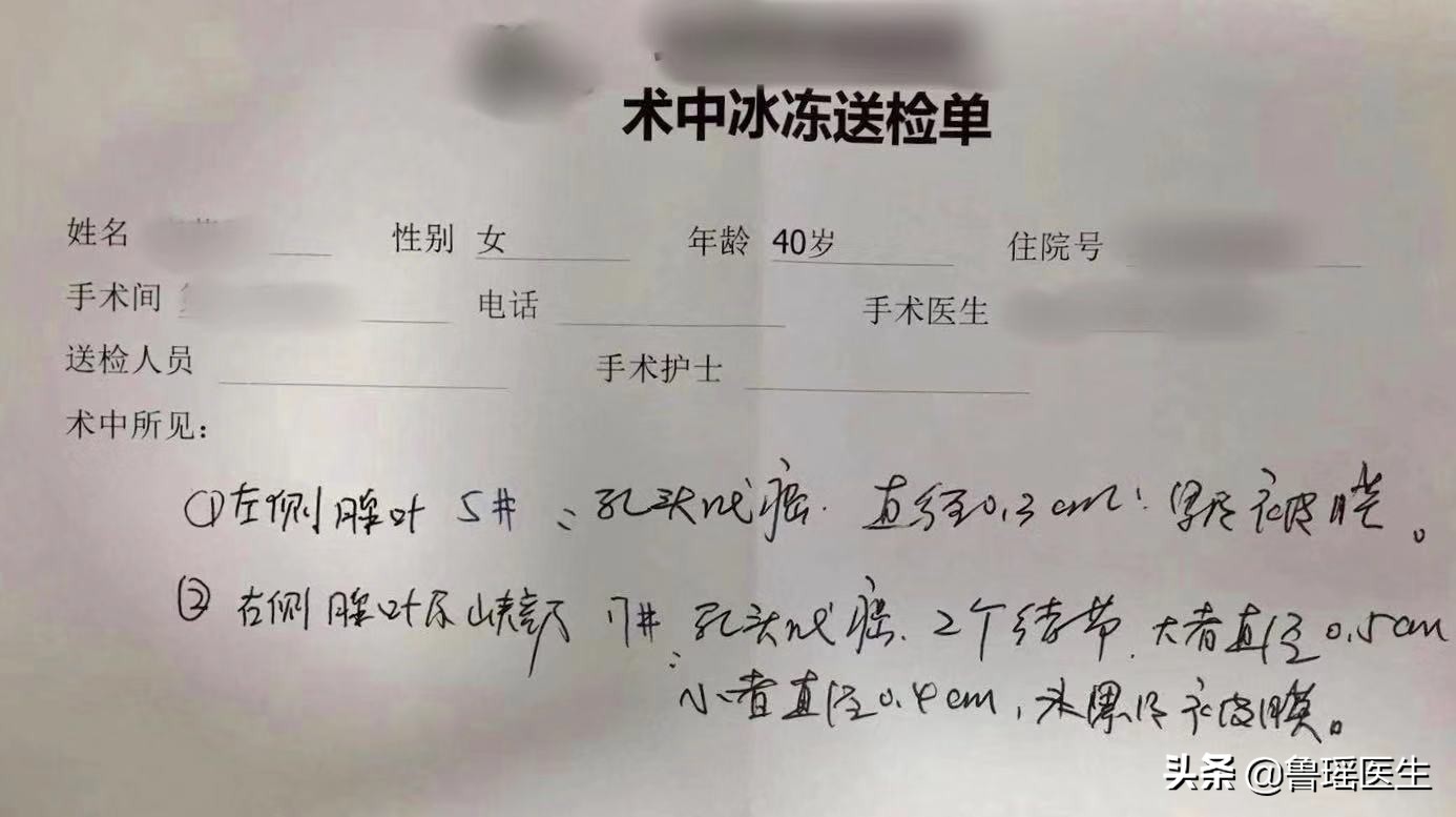 不同医院做的甲状腺B超结果会有差异吗？