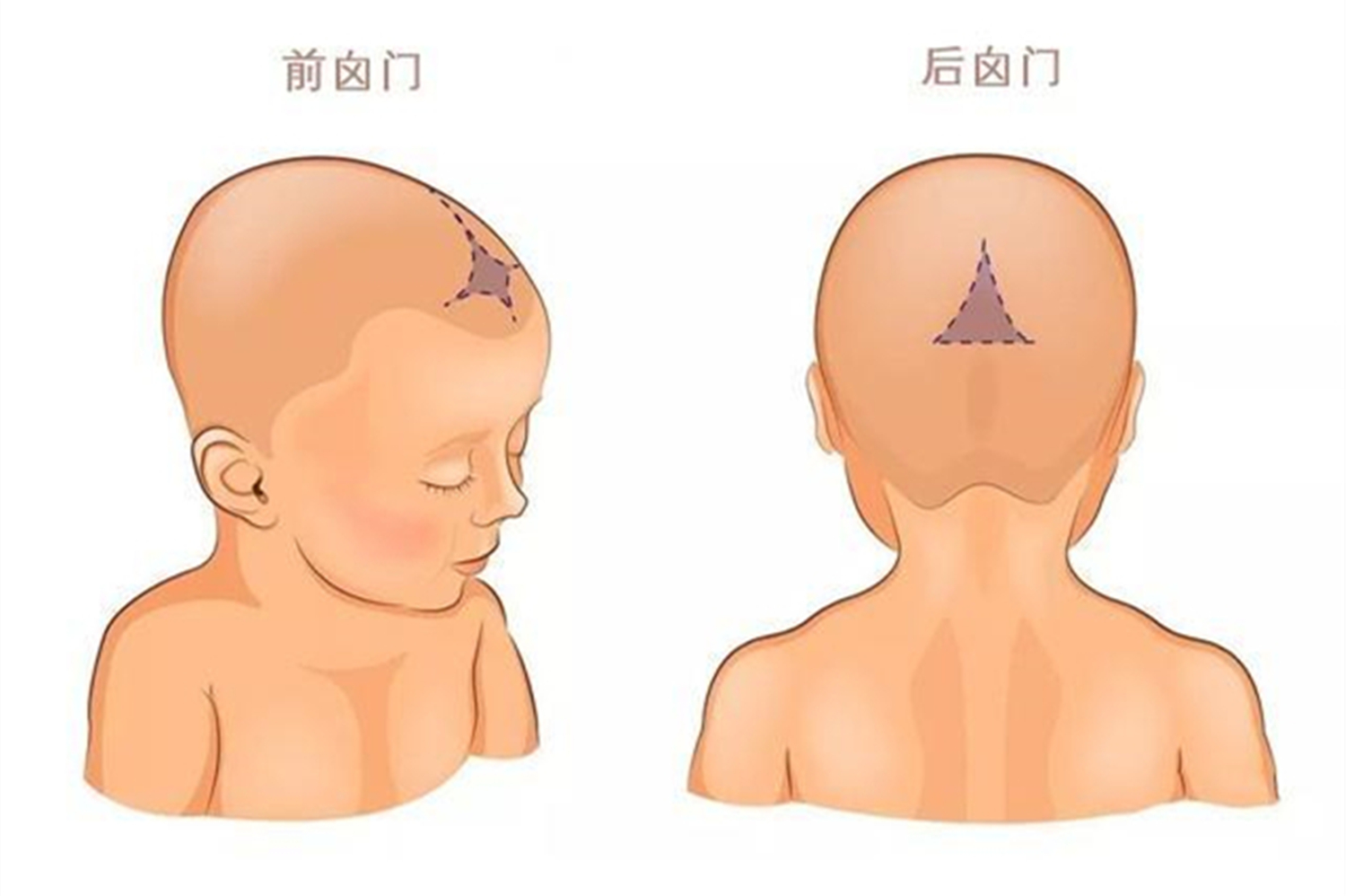 囟门闭合的时间，与宝宝的大脑发育有关，尤其有三种情况要重视