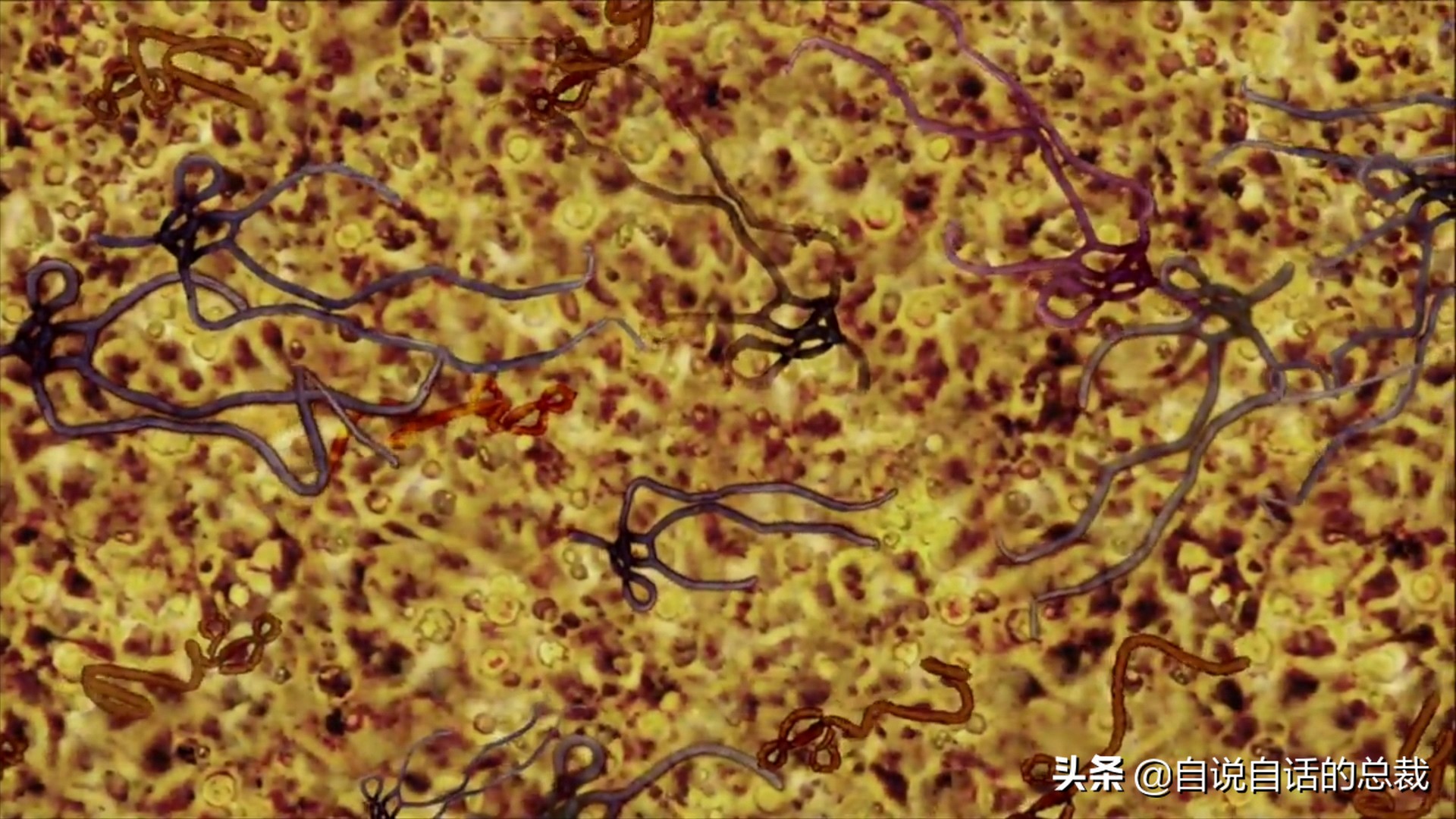 埃博拉：人类的诅咒，你的身体如何对抗它，它到底有多恐怖