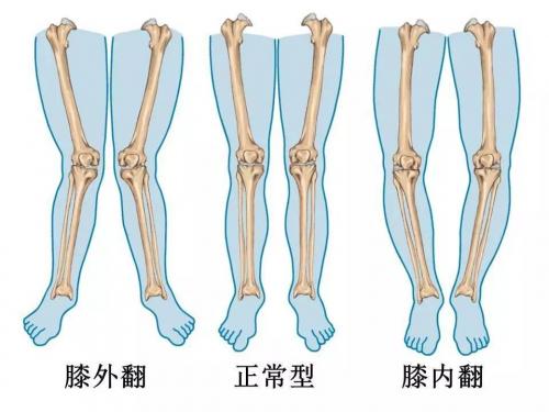 邱医生，我总觉孩子的脚与腿有问题！看看是啥呢？