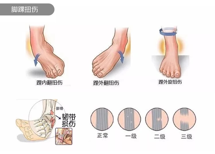 nba崴脚为什么好得这么快(从东契奇的崴脚，学习NBA级别的康复流程)