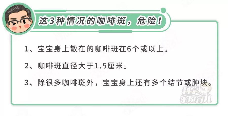 听过100种胎记的传说，有人告诉你这几种胎记可致命吗？