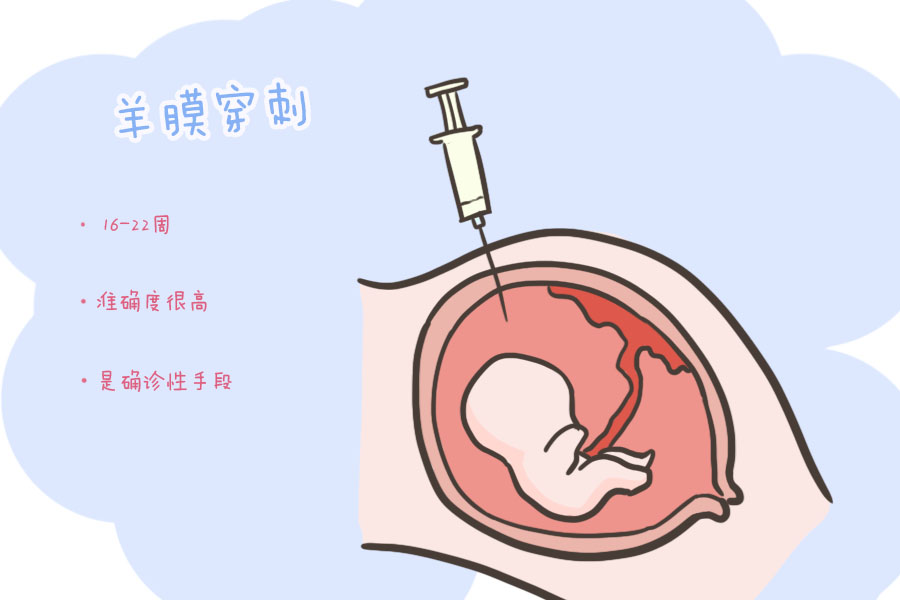 唐筛检查即便是低风险也要当心，特别是高危孕妈，别在这方面省钱