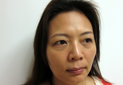 形态:泪沟又叫睑袋沟,指的是有内眼角开始直到下眼睑靠近鼻侧的一条凹