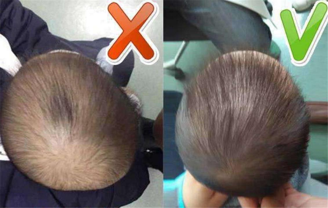 女儿后脑勺"平如锅底",妈妈一招补救,做法得到医生的点赞