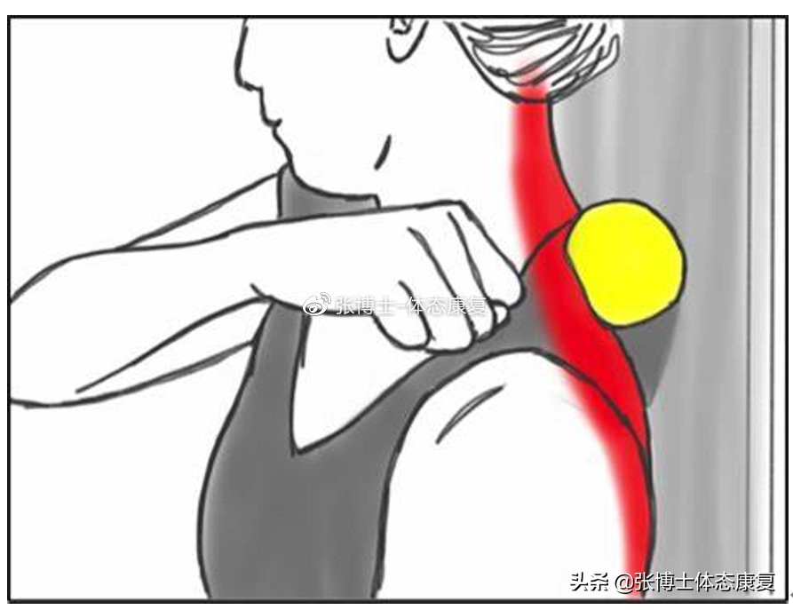 「体态康复」缓解颈部僵硬酸痛的拉伸方法