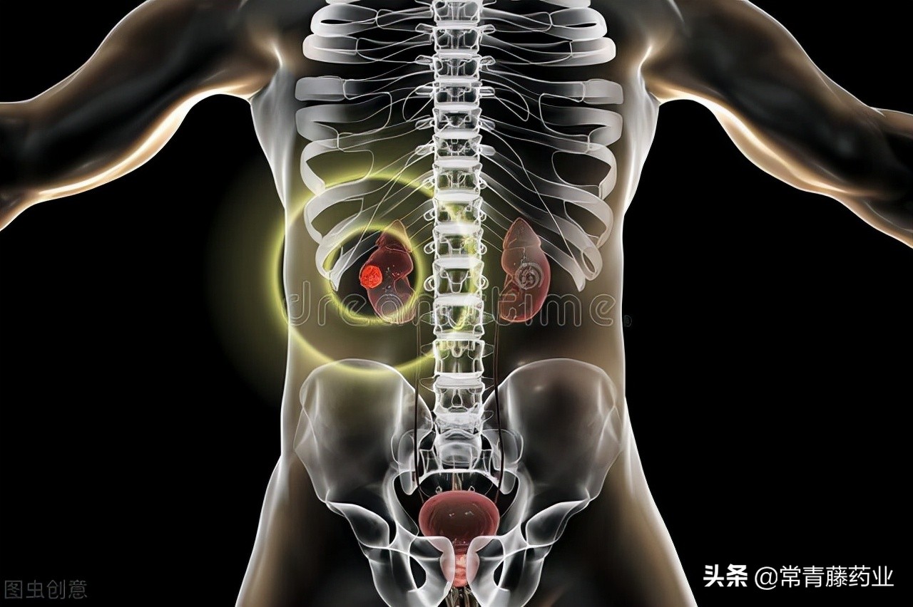 肾癌有什么治疗？了解一下，根治性肾切除术、保留肾单位手术