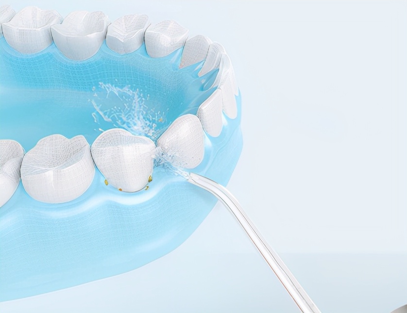 牙齿缝隙牙刷清洗不到怎么办，你需要一个Flosmore冲牙器