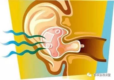 协和蒋子栋：细说耳鸣