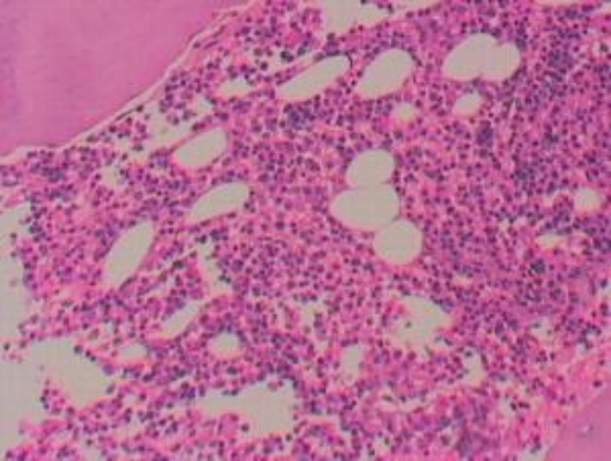 湖南高三美女学霸，生命定格在高考前夕，临终的遗嘱令人泪目