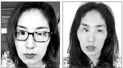 徒手整骨调查：号称不开刀不出血就能瘦脸，是不是忽悠？