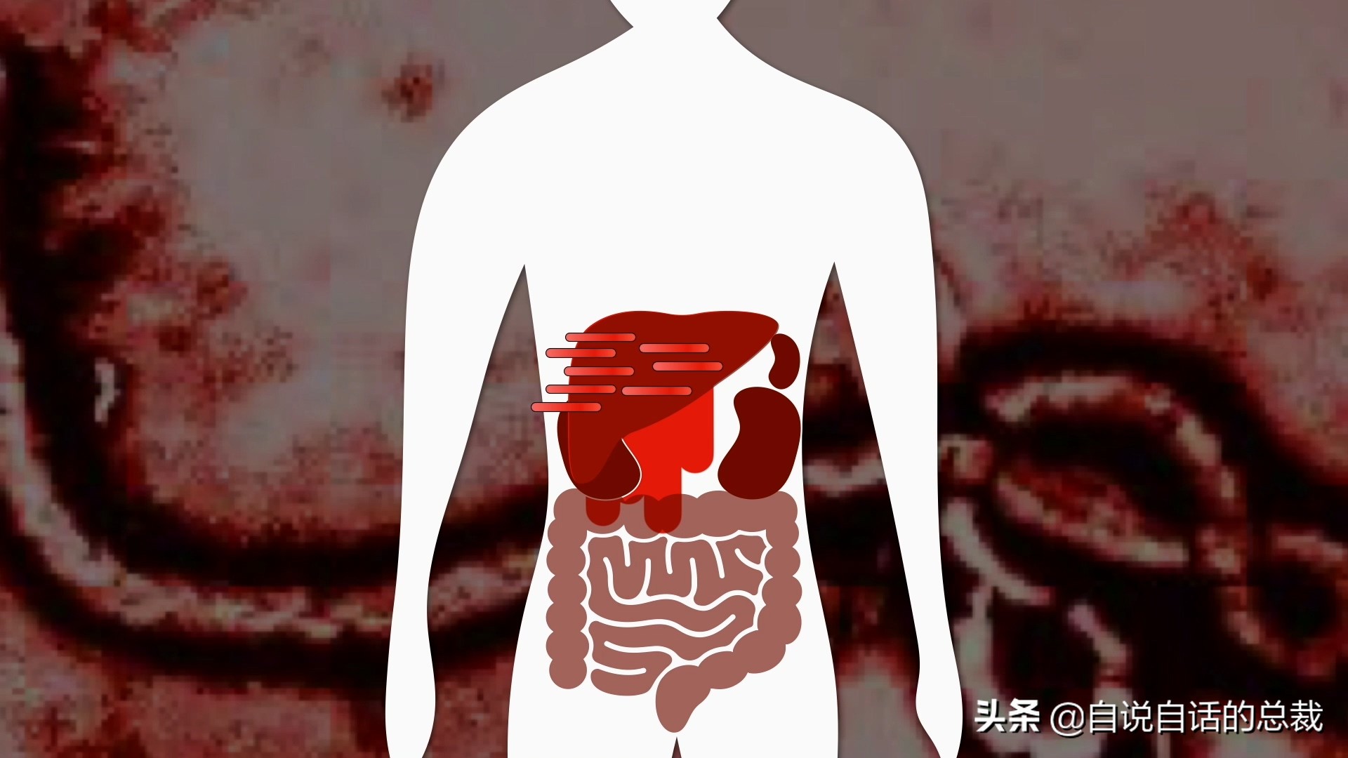 埃博拉：人类的诅咒，你的身体如何对抗它，它到底有多恐怖