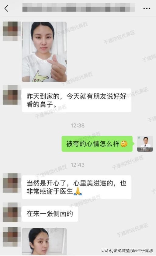 肋软骨鼻修复改善L型鼻，31岁妈妈拒绝歪鼻，术后变回气质宝妈