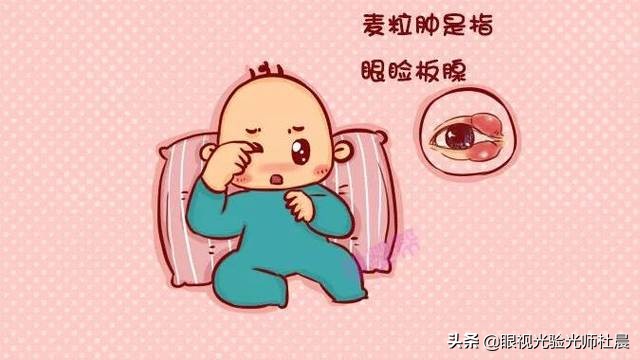 婴儿麦粒肿（宝宝眼睛长小疙瘩）