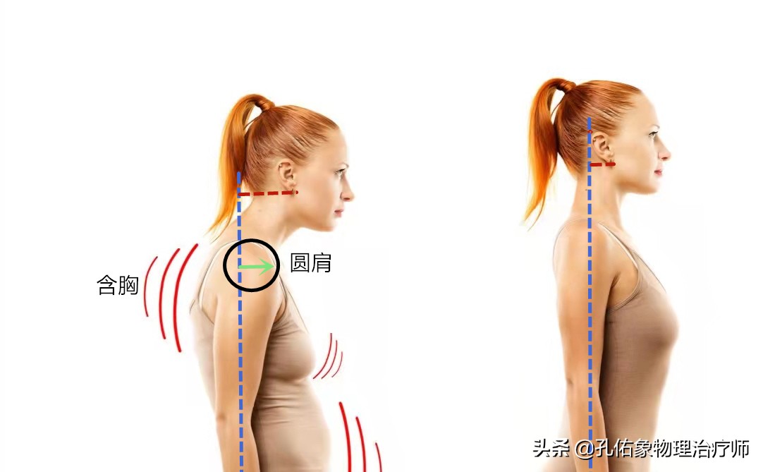 後背,肩胛骨區域疼痛是怎麼回事?如何應對?告訴您