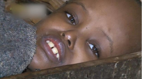 卢旺达妇女产下"外星人之子",头部是三角形