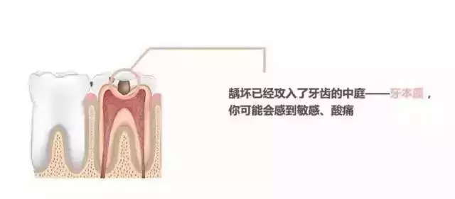 你补过牙吗?知道价格为什么差那么多吗?