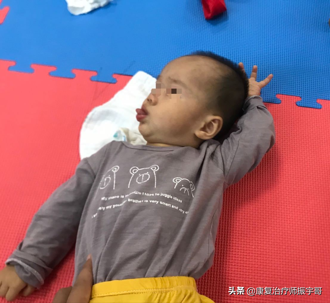 宝宝翻身早,大拇指内扣,小心肌张力过高