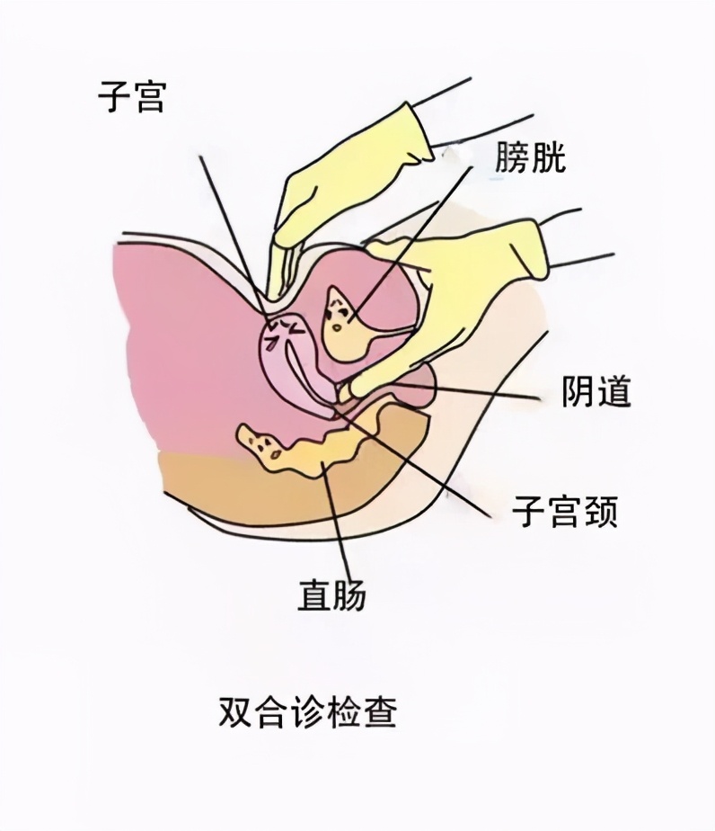 但是这个双合诊必须征得患者同意且全程佩戴手套,一些基本按压属于
