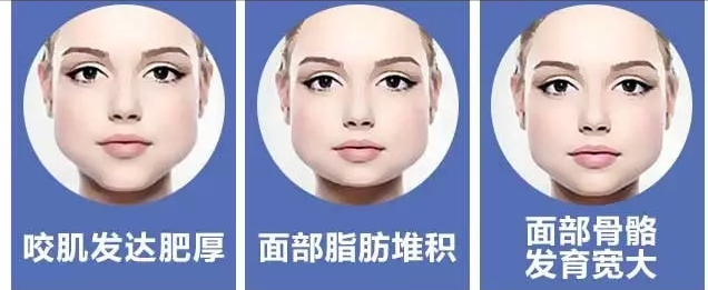 凭什么就你脸大？4大维度的“削骨瘦脸”造型方案，可别怪我没说