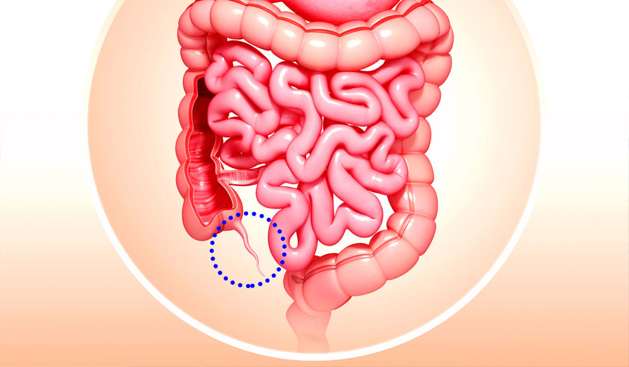 阑尾是人体肠道的一个小部分,细长弯曲的管道,像一条蚯蚓,一端和盲肠