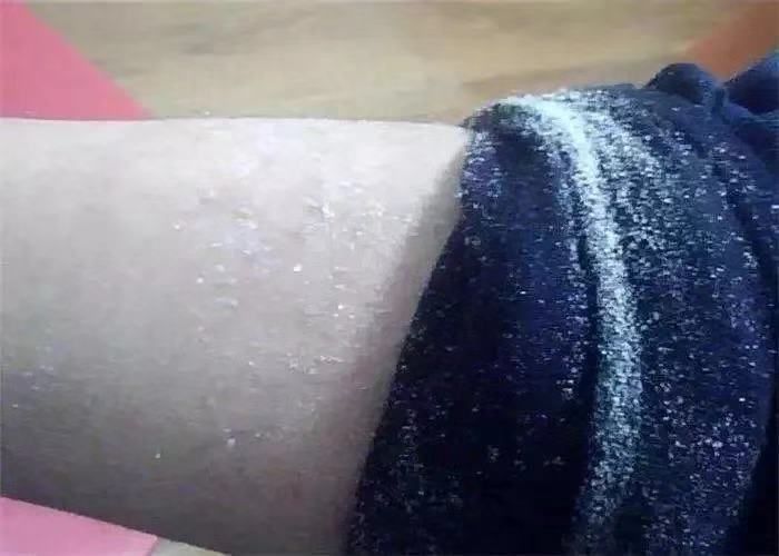 冬天一到，身体就干燥起皮？护肤达人教你一招，只需抹一下就好了