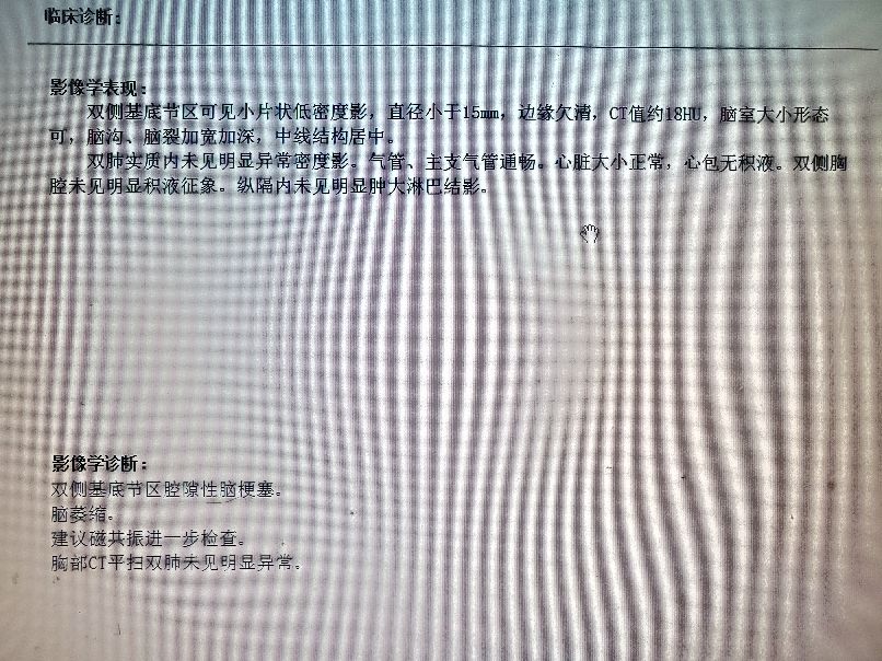 头晕恶心呕吐怎么办？快速缓解方法