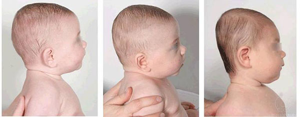 扁头的宝宝更有福？没有科学依据，但对颜值却有很大的影响