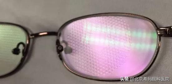 这四大青少年近视防控“神器”，你更“青睐”谁？