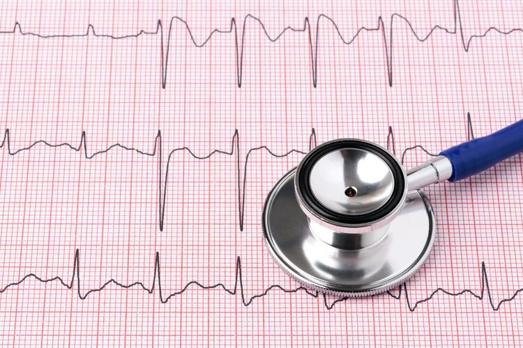 体检查出“窦性心律”是啥意思？心律不齐是心脏病吗？可算明白了