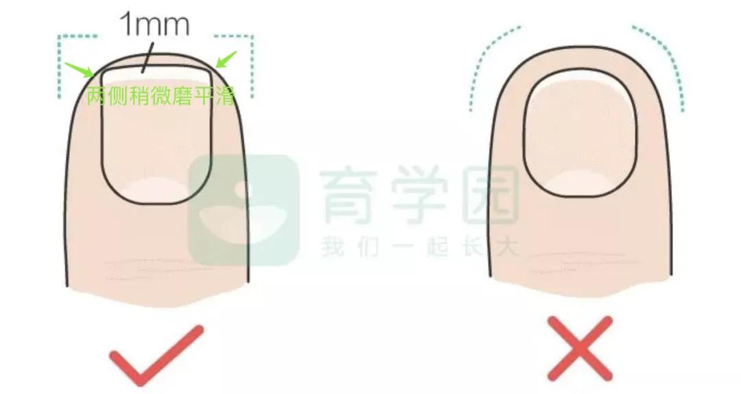 ​警惕「夺命」黑线！宝宝指甲有这5种表现，预示着健康危机