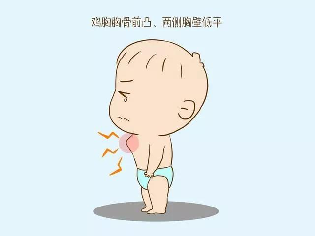 宝宝缺钙的表现有哪些,如何补钙