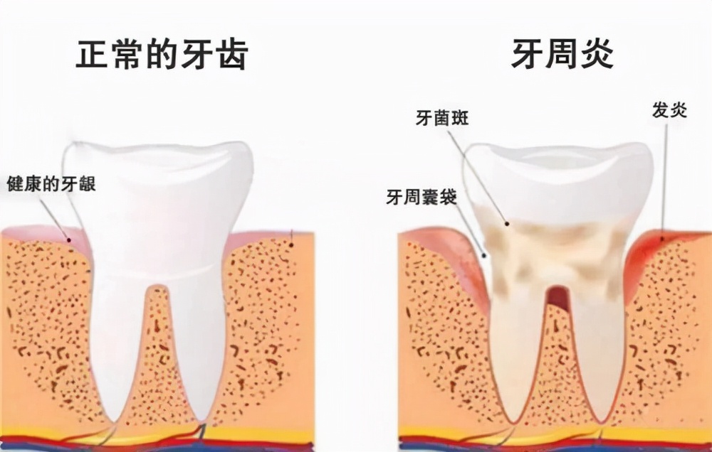 身上最坚硬的部位：“牙齿”松动怎么办？能保别弃