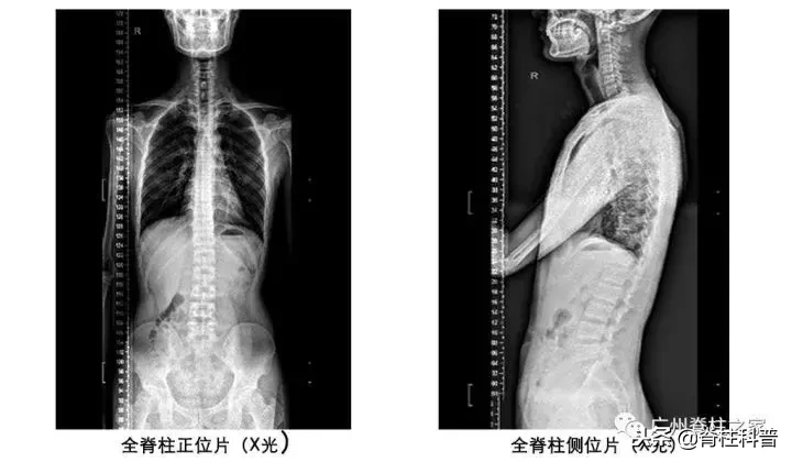 在骨科，X光、CT、MRI（核磁共振）各有优势，不是越贵越好！