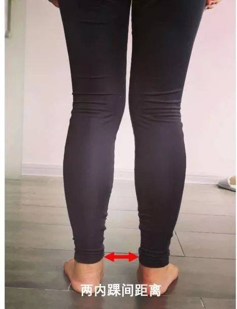 腿粗,腿肚子大,小萝卜腿怎么拯救?你需要了解这样