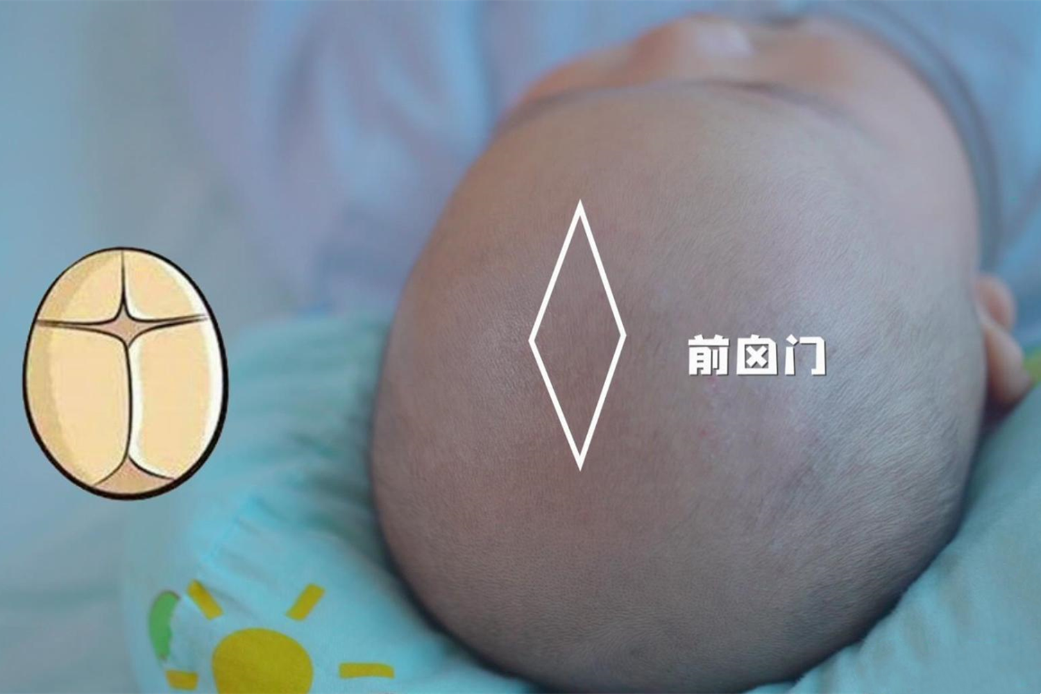 囟门的6种变化,代表孩子不同的健康状况