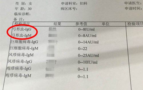 辟谣！怀孕不能养猫？十恶不赦的弓形虫根本没那么容易感染！